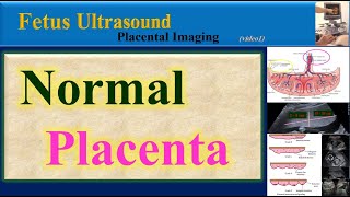 Placenta  Anatomy  Surface  Structure  Hindi [upl. by Zeiler704]