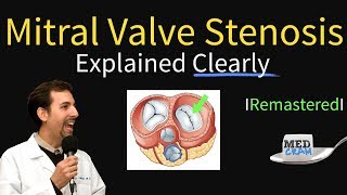 Recognizing Aortic Stenosis Symptoms [upl. by Forrester]