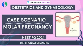 Case Scenario  Molar Pregnancy  NEET PG 2021  Dr Shonali Chandra [upl. by Elatnahs]