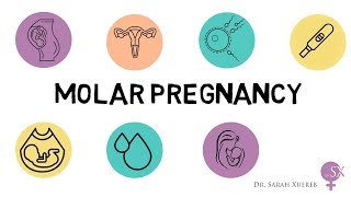 Molar Pregnancy [upl. by Aicenod]