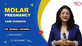 Molar Pregnancy  Case Scenario  Dr Shonali Chandra [upl. by Nivlek638]