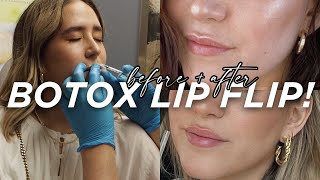 The Secret to Natural and Beautiful Lips  with Dr Bouzoukis [upl. by Dulsea]