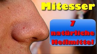 Mitesser – 7 Natürliche Heilmittel gegen Mitesser und Pickel [upl. by Aneerehs]