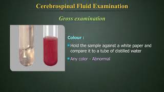 Cerebrospinal Fluid Examination CSF [upl. by Eellek]