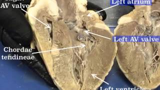 Sheep Heart Dissection  Part 2 [upl. by Eliason]