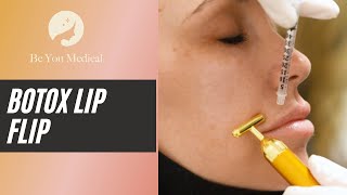 Botox Lip Flip [upl. by Esinaej]