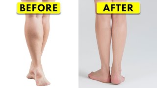 How I Slimmed Down My HUGE Calves  Scientific Approach [upl. by Emelina]