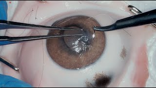 Cornea Suture 101 [upl. by Asille]