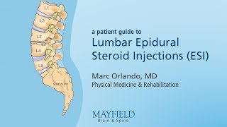 Lumbar Epidural Steroid Injections [upl. by Assi59]