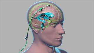 Cerebrospinal Fluid  Neuroanatomy [upl. by Susann]