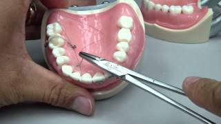 Root Coverage  Sling Suture [upl. by Grew]