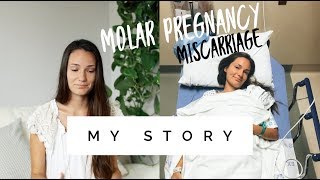 My untold Molar Pregnancy MISCARRIAGE story [upl. by Leunamnauj]