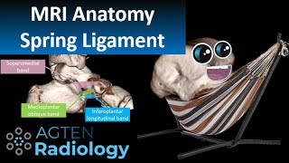 Spring Ligament Complex MRI Anatomy [upl. by Antebi931]