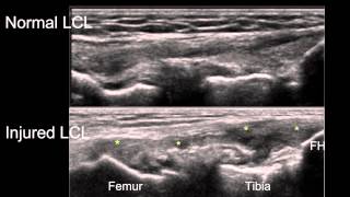 Anatomy of the Knee Joint [upl. by O'Carroll]