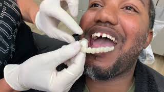 Houston Cosmetic Dentist How to close those gaps without braces affordably [upl. by Krein]