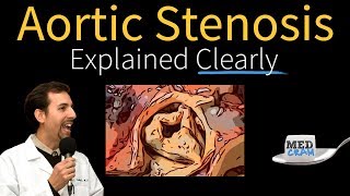 Aortic Valve Stenosis An Overview and Potential Treatments [upl. by Karlene]