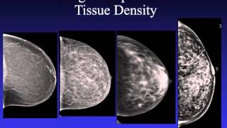 Introduction to Mammography [upl. by Quent198]