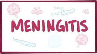 Meningitis  causes symptoms diagnosis treatment pathology [upl. by Allenod374]