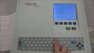 Schiller Cardiovit AT102 Basic Functions [upl. by Aiyotal]