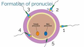 APGO Basic Sciences  Topic 19 Gestational Trophoblastic Disease [upl. by Deron]