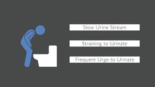 Trouble Urinating What Causes Urinary Issues in Men [upl. by Bouldon]