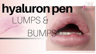 Filler Lumps and Bumps  Hyaluron Pen [upl. by Giselbert]