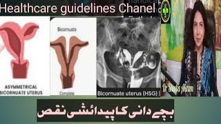 BICORNUATE UTERUS [upl. by Leuams]