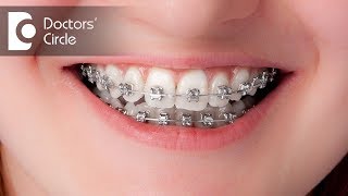 How long will it take to close the gaps with invisible braces  Dr Shobith R Shetty [upl. by Sylas48]